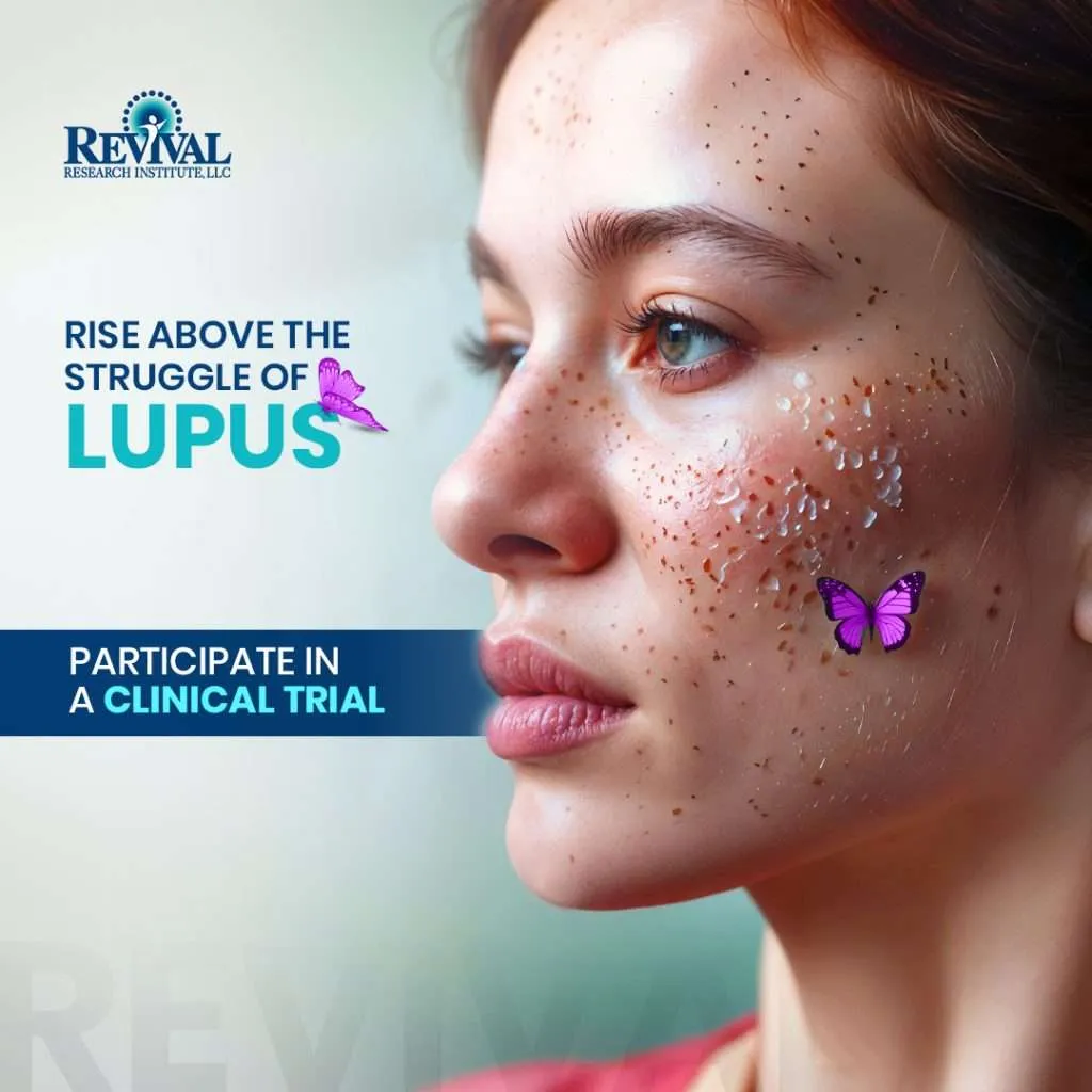 Lupus-Lead-Generation-Ads.V1-1024x1024